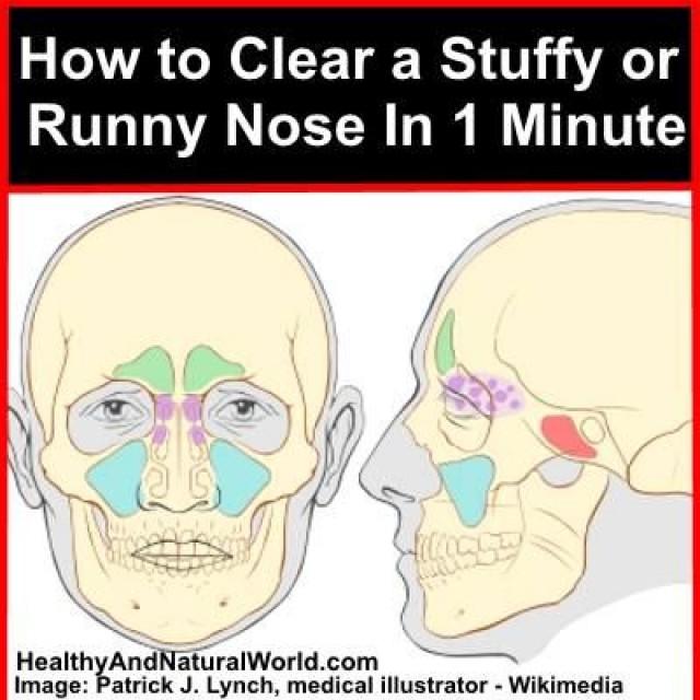 how-to-clear-a-stuffy-or-runny-nose-in-1-minute-2376402-weddbook