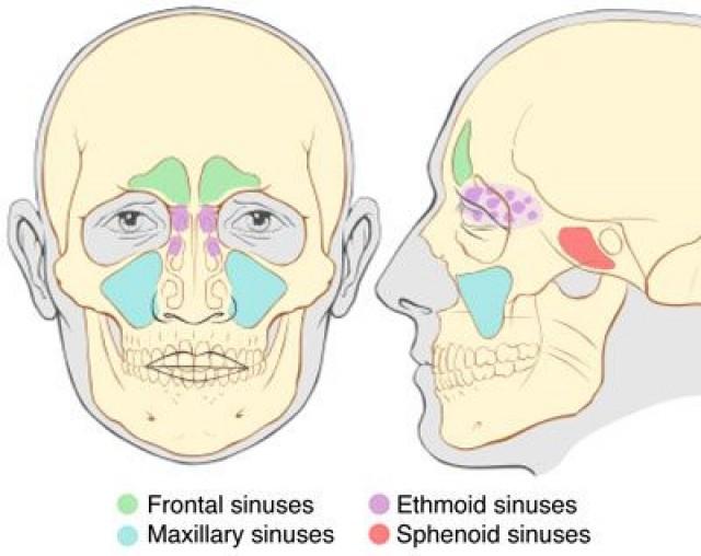 Sinus Infection Remedies (Without Antibiotics) 2380280 Weddbook