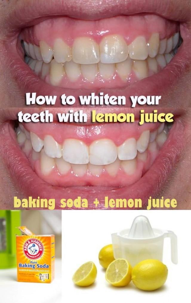 lemon and baking soda on teeth