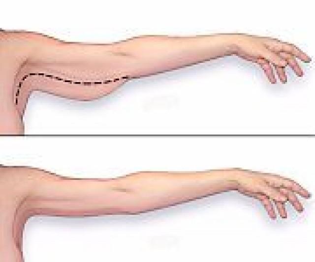 Here s How To Tone Your Arms Without Weights 2485317 Weddbook