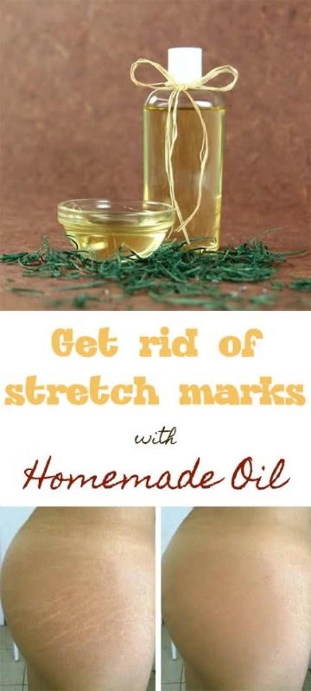 Get Rid Of Stretch Marks With Homemade Oil 2518099 Weddbook